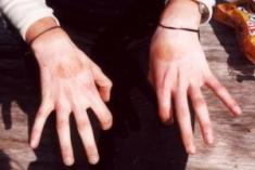 Amy's Hands